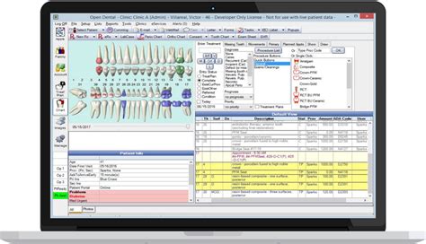 open dental credit card smart terminals|open dental credit card software.